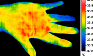红外热像仪检测出中发冷的第4和第5手指