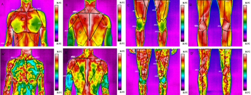 越野滑雪者从身体后表面与表面的体温谱图